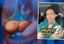 El médico Richard Suárez se refirió al hígado graso.