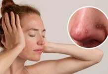 Cómo el estrés afecta tu piel y qué hacer para mantenerla sana y luminosa La rutina suave recomendada por expertos